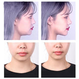 Load image into Gallery viewer, 40-120PCS V-Shape Face Wrinkle Sagging Skin